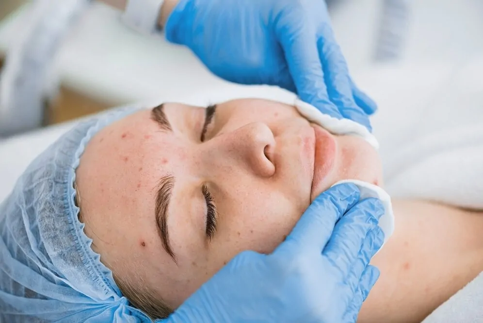 Pigmentation Treatment